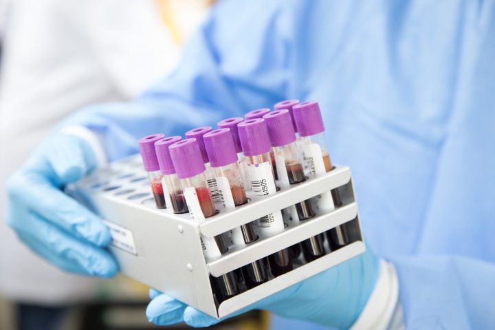 Blood & Urine Tests