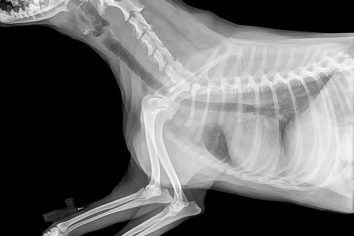 Digital X-Ray